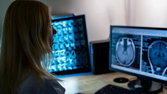 Oncoclínicas despenca após call com analistas